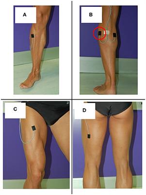 Surface Electromyography Applied to Gait Analysis: How to Improve Its Impact in Clinics?